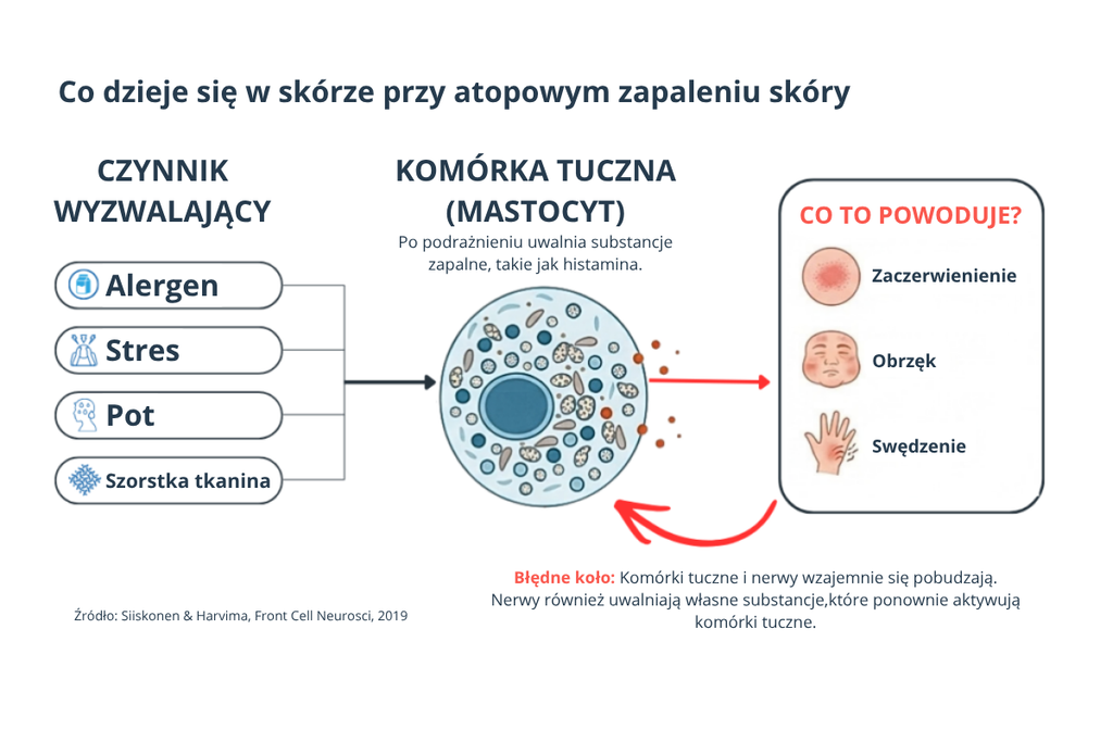Co dzieje się w skórze przy atopowym zapaleniu: alergen, stres, pot i szorstka tkanina pobudzają komórkę tuczną, która uwalnia histaminę i wywołuje zaczerwienienie, obrzęk i swędzenie